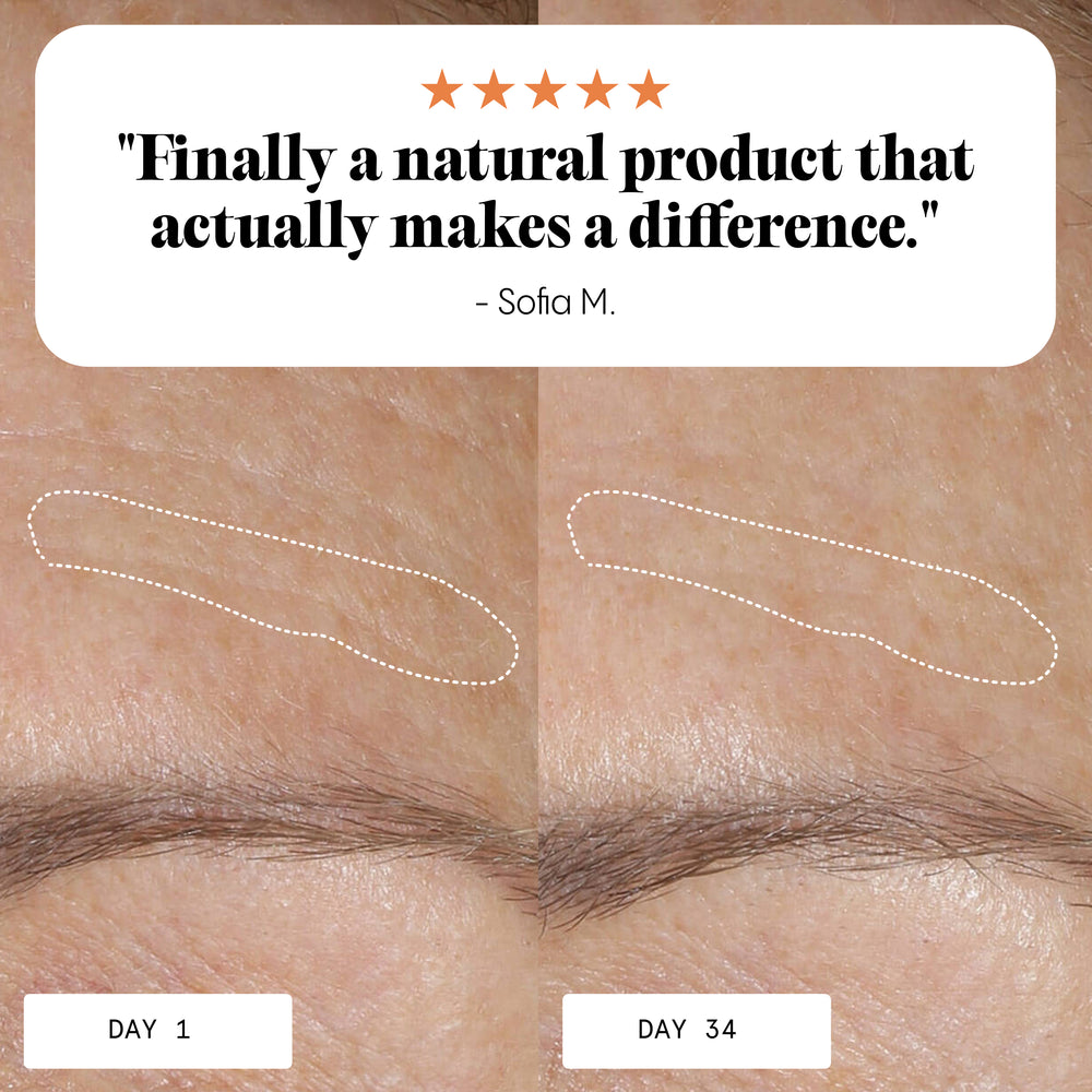 Before and after skin improvement with Frøya Organics Anti-Age & Insane Glow Day Balm