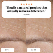 Before and after skin improvement with Frøya Organics Anti-Age & Insane Glow Day Balm