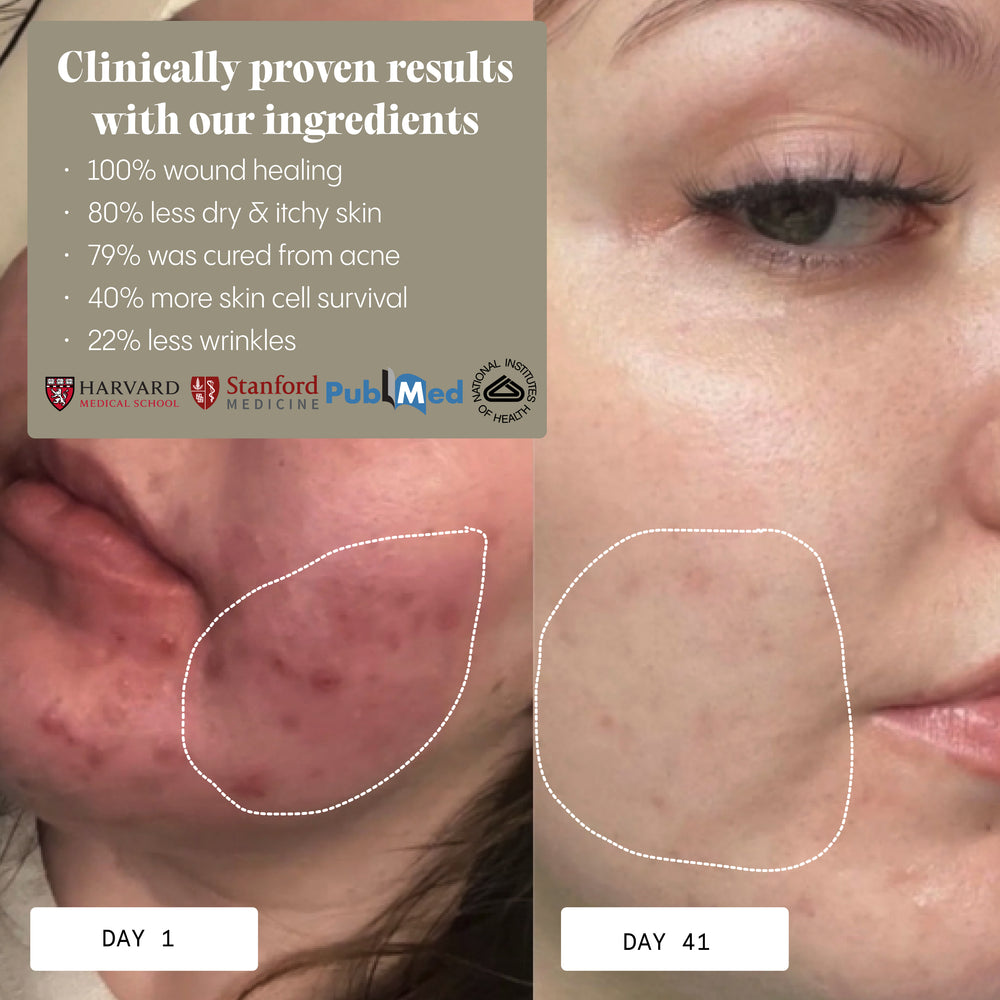 Frøya Organics Anti-Age & Insane Glow Day Balm 100% satisfaction money-back guarantee badge