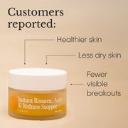 The Complete System for Acne-Prone Skin