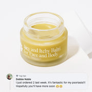 Dry and Itchy Balm for Face and Body