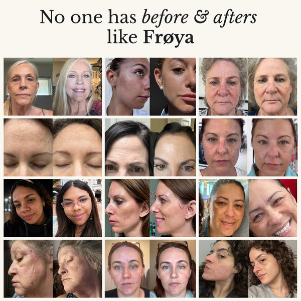 Bálsamo para Piel Seca y con Picazón – Rostro y Cuerpo