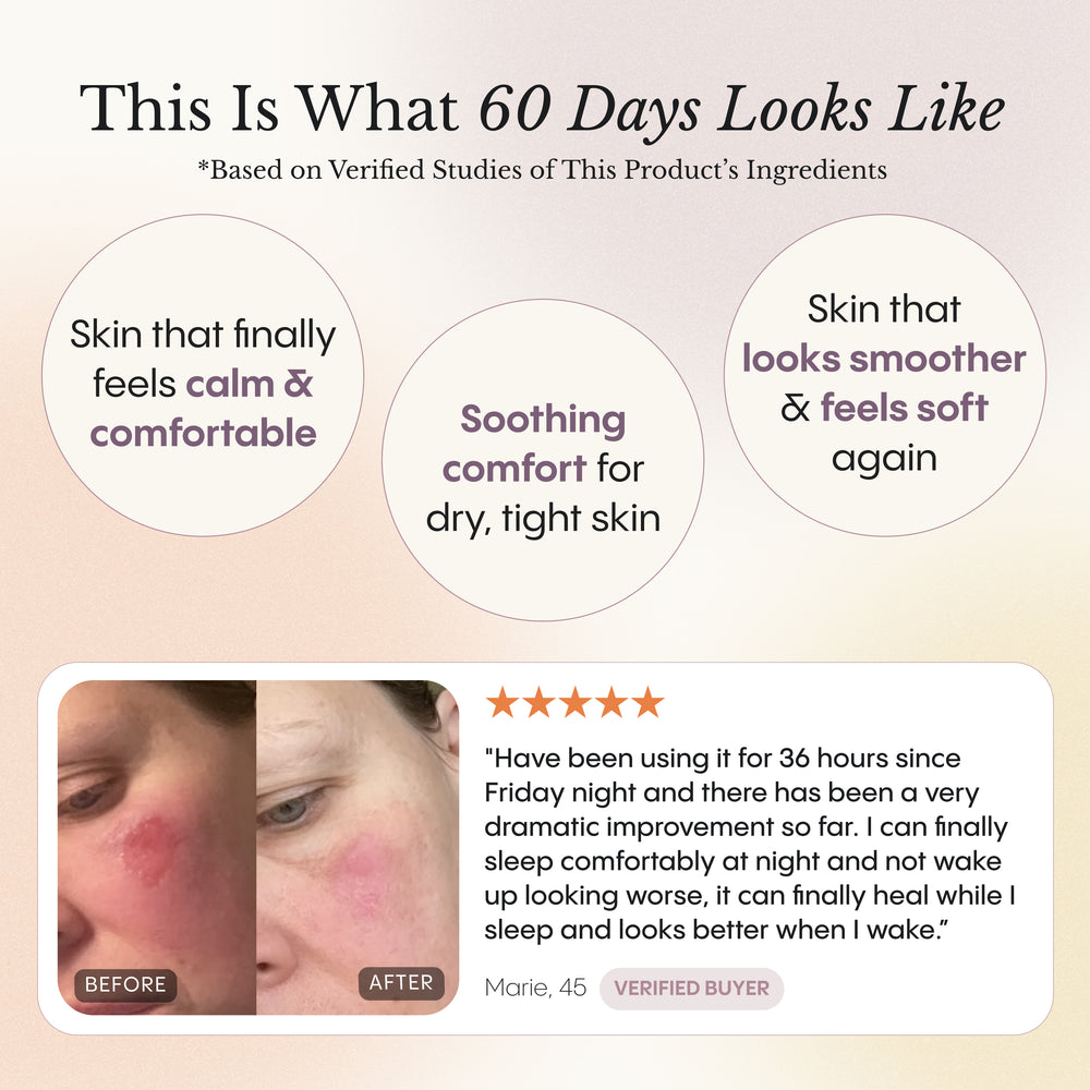 Dry and Itchy Balm for Face and Body