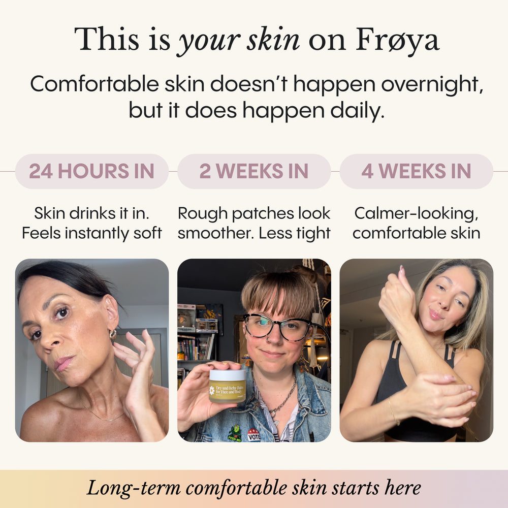 Dry and Itchy Balm for Face and Body