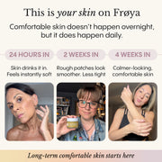 Dry and Itchy Balm for Face and Body