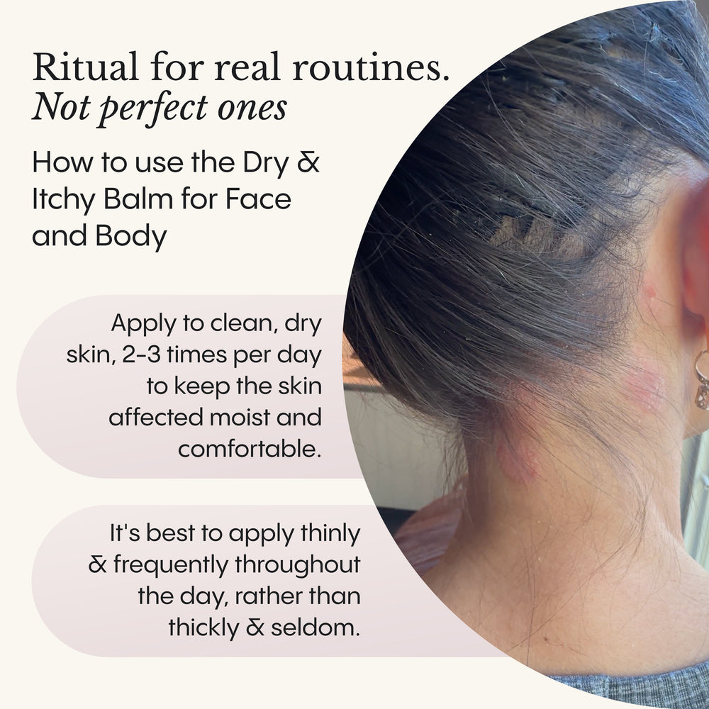 Dry and Itchy Balm for Face and Body