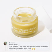 Frøya Organics Ultra-Fast Relief Balm in glass jar with lid – eczema and psoriasis balm front view