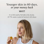 Frøya Organics Hyper Potent Dark Circles & Bag Eye Balm open jar revealing concentrated organic eye balm texture
