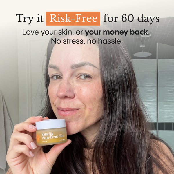 Balm for Acne-Prone Skin