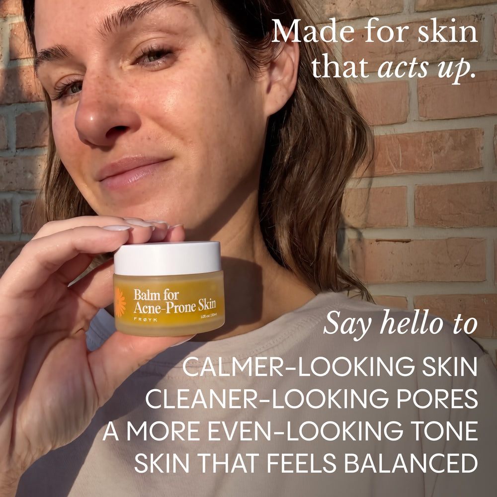 Balm for Acne-Prone Skin