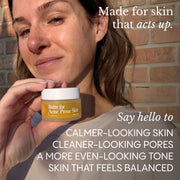 Balm for Acne-Prone Skin