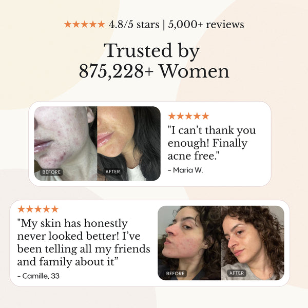 Balm for Acne-Prone Skin