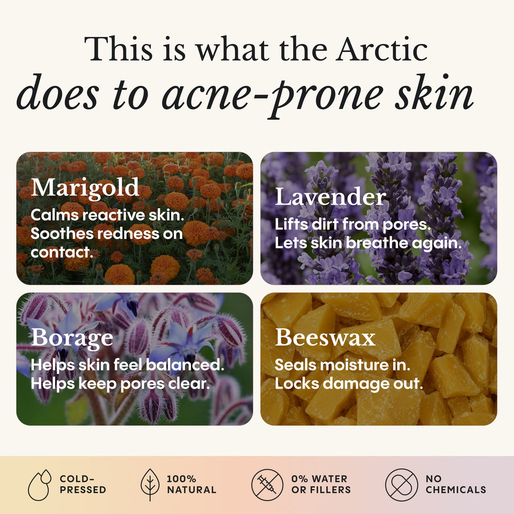 Balm for Acne-Prone Skin