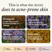 Balm for Acne-Prone Skin