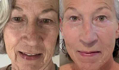 Joan, 64