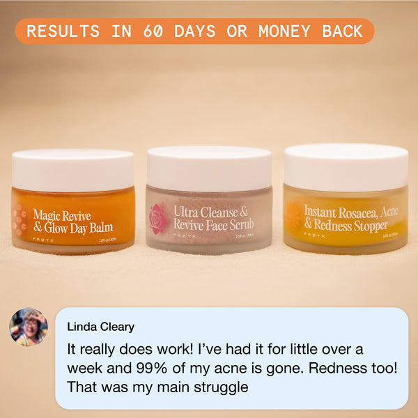 The Complete Acne System for Women