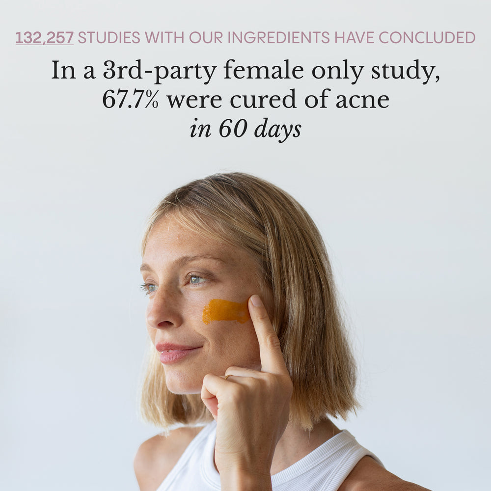 Frøya Organics Complete Acne System for Women 100% satisfaction money-back guarantee badge