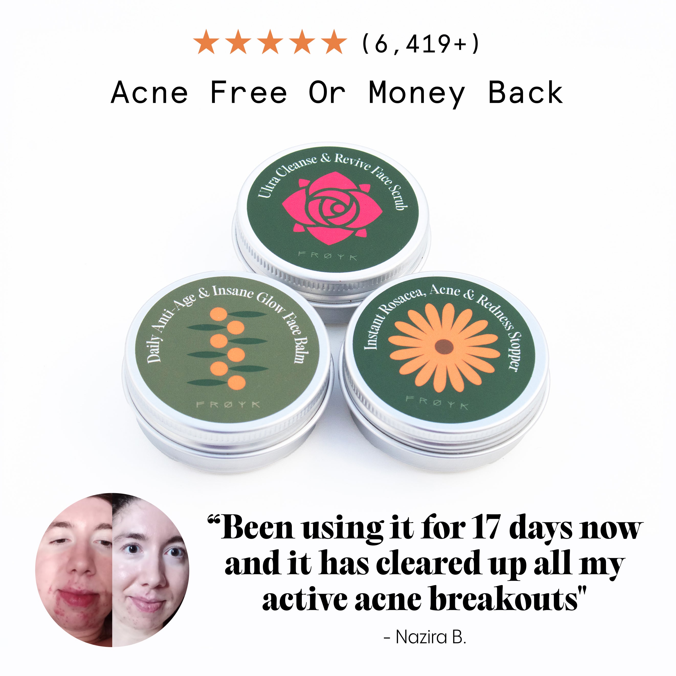 The Complete Acne System for Women