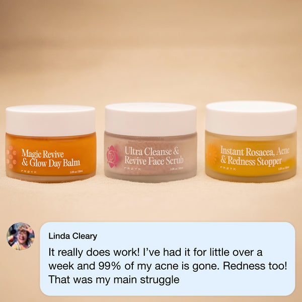 The Complete System for Acne-Prone Skin