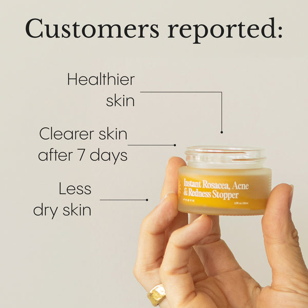 The Complete System for Acne-Prone Skin