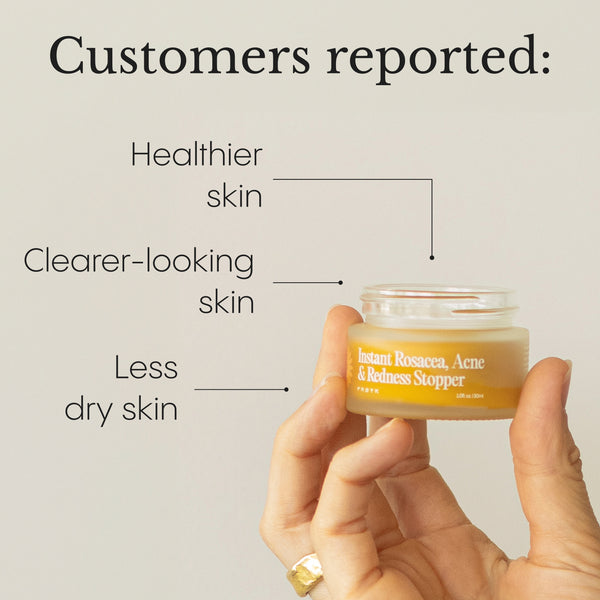 The Complete System for Acne-Prone Skin