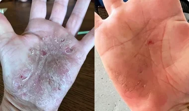 Real transformation from a real customer