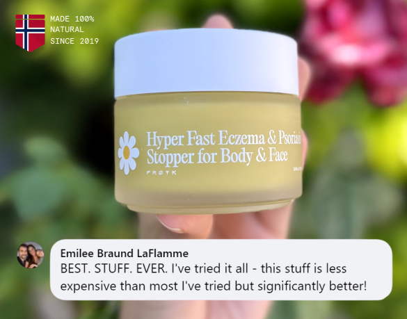 <p>Eczema & Psoriasis<br/><em><strong>Gone In 2 Weeks</strong></em></p>