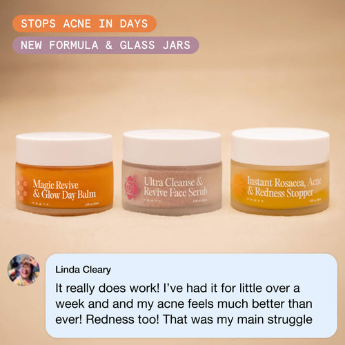The Complete Acne System for Women