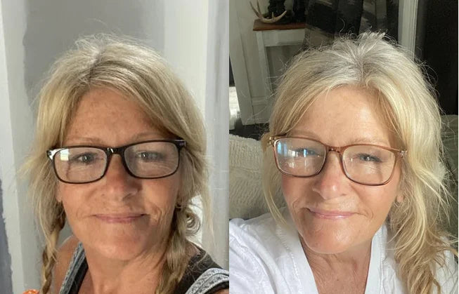 Eine Kundin vor und nach regelmäßiger Anwendung